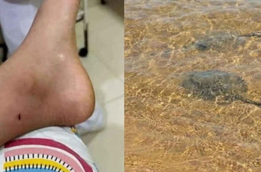  Dos niños fueron atacados por rayas en playa de Encarnación