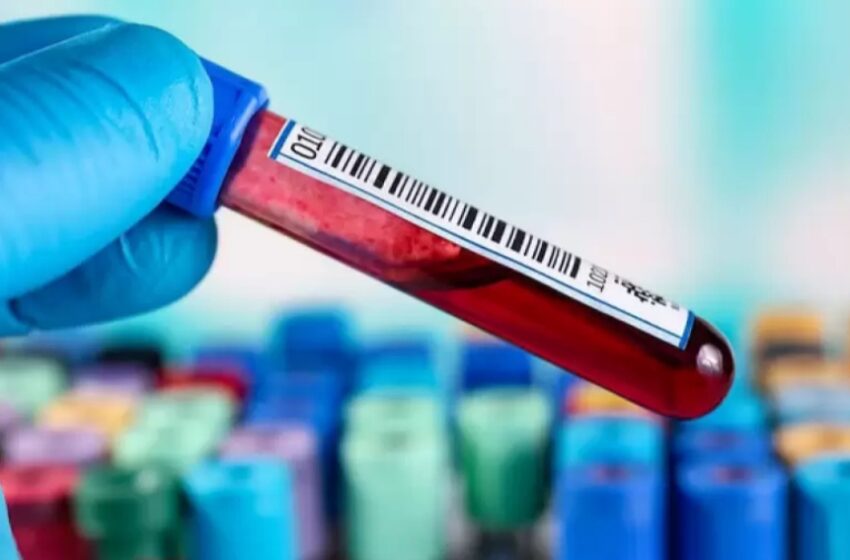  Un avance en terapia inmunitaria podría facilitar el tratamiento contra la leucemia