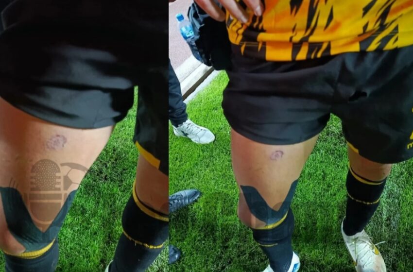  Bolivia. Paraguayo Godoy es herido por bengala