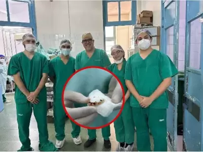  Extraen cinco dientes del pulmón de un paciente en el Ineram