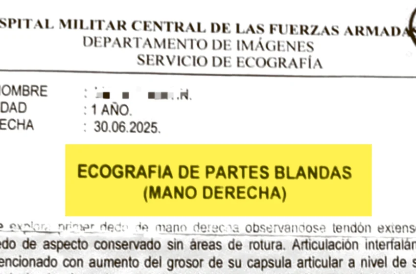  Le operaron la mano equivocada a una beba