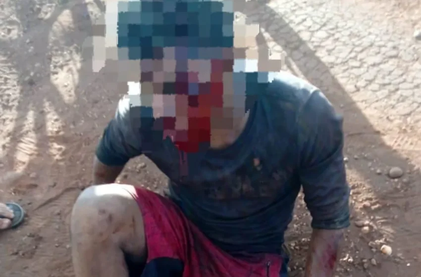  Camioneta atropella a un adolescente y se da a la fuga en Pedro Juan Caballero