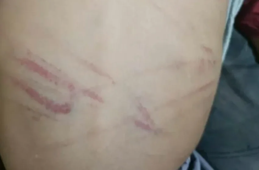  Una mujer es señalada por golpear con cable a su hijastro de 3 años y queda detenida en Capiatá